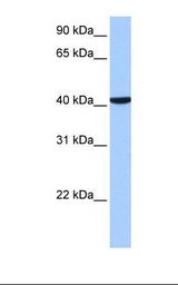 Placenta cell lysate. Antibody concentration: 1.0 ug/ml. Gel concentration: 12%.