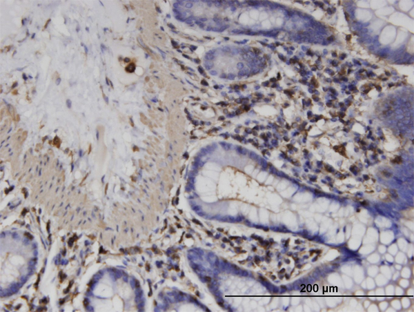Immunoperoxidase of monoclonal antibody to ACTRT2 on formalin-fixed paraffin-embedded human colon. [antibody concentration 3 ug/ml]