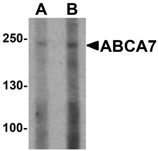 Western blot analysis of ABCA7 in 293 cell lysate with ABCA7 antibody at (A) 1 and (B) 2 ug/ml.