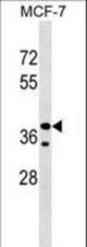 CCBE1 Antibody western blot of MCF-7 cell line lysates (35 ug/lane). The CCBE1 antibody detected the CCBE1 protein (arrow).