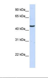 Fetal brain lysate. Antibody concentration: 1.0 ug/ml. Gel concentration: 12%.