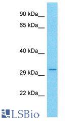 CCDC101 antibody Western Blot of Jurkat. Antibody dilution: 1 ug/ml.