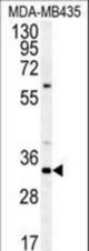 Western blot of SGF29 Antibody in MDA-MB435 cell line lysates (35 ug/lane). SGF29 (arrow) was detected using the purified antibody.