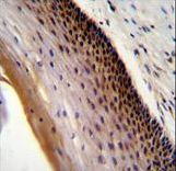 CCDC102A Antibody immunohistochemistry of formalin-fixed and paraffin-embedded human cervical tissue followed by peroxidase-conjugated secondary antibody and DAB staining.