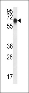CCDC102A Antibody western blot of mouse bladder tissue lysates (35 ug/lane). The CCDC102A antibody detected the CCDC102A protein (arrow).