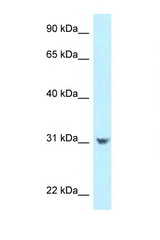 CCDC102B antibody LS-C145955 Western blot of HepG2 Cell lysate. Antibody concentration 1 ug/ml.