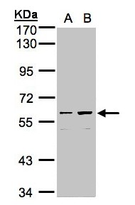 Sample (30g whole cell lysate). A: Hep G2 , B: MOLT4 . 7.5% SDS PAGE. HsT1731 / CCDC102B antibody diluted at 1:1000