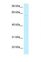 CCDC105 antibody LS-C145926 Western blot of HeLa Cell lysate. Antibody concentration 1 ug/ml.