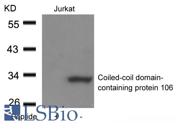 Western blot of extracts from Jurkat cells using Coiled-coil domain-containing protein 106 antibody and the same antibody preincubated with blocking peptide.