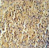CC106 Antibody immunohistochemistry of formalin-fixed and paraffin-embedded human spleen tissue followed by peroxidase-conjugated secondary antibody and DAB staining.