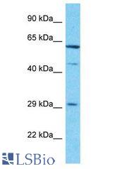 CCDC107 antibody Western Blot of Jurkat. Antibody dilution: 1 ug/ml.