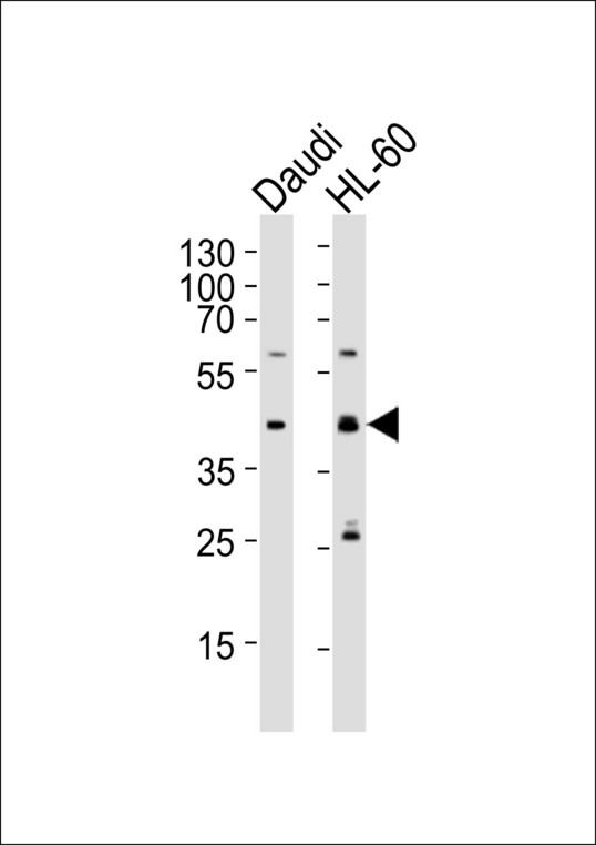 Western blot of lysates from Daudi, HL-60 cell line (from left to right), using C109B Antibody. Antibody was diluted at 1:1000 at each lane. A goat anti-rabbit IgG H&L (HRP) at 1:5000 dilution was used as the secondary antibody. Lysates at 35ug per lane.