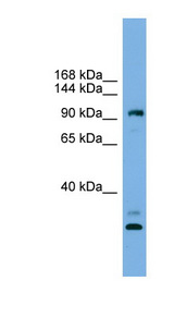 CCDC110 antibody LS-C116621 Western blot of HeLa lysate.