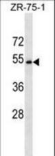 CCDC112 Antibody western blot of ZR-75-1 cell line lysates (35 ug/lane). The CCDC112 antibody detected the CCDC112 protein (arrow).