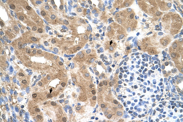 CCDC112 antibody LS-C40505 IHC of formalin-fixed, paraffin-embedded human Kidney. Positive label: Epithelial cells of renal tubule indicated with arrows. Antibody concentration 4-8 ug/ml. Magnification 400X.