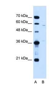 CCDC112 antibody LS-C40505 Western blot of Jurkat lysate.