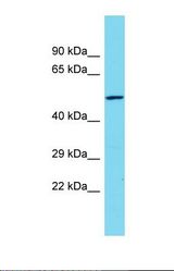 Western blot of Human HT1080. CCDC114 antibody dilution 1.0 ug/ml.