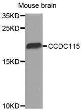 Western blot analysis of extracts of Mouse brain cell line, using CCDC115 antibody.