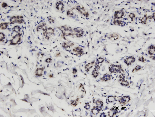 Immunoperoxidase of monoclonal antibody to CCDC115 on formalin-fixed paraffin-embedded human breast. [antibody concentration 1.5 ug/ml]