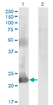 Western blot of CCDC115 expression in transfected 293T cell line by CCDC115 monoclonal antibody (M05), clone 4E9.