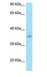 CCDC117 antibody Western Blot of HeLa.
