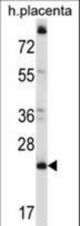 CCDC117 Antibody western blot of human placenta tissue lysates (35 ug/lane). The CCDC117 antibody detected the CCDC117 protein (arrow).