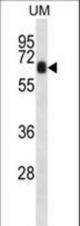 CCDC120 Antibody western blot of uterus tumor cell line lysates (35 ug/lane). The CCDC120 antibody detected the CCDC120 protein (arrow).
