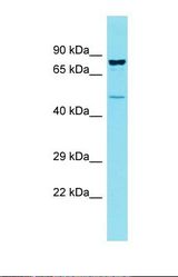 Western blot of Human OVCAR-3. CCDC121 antibody dilution 1.0 ug/ml.