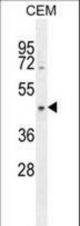 CCDC122 Antibody western blot of CEM cell line lysates (35 ug/lane). The CCDC122 antibody detected the CCDC122 protein (arrow).