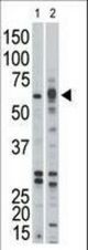 The anti-ACVR1B antibody is used in Western blot to detect ACVR1B in Jurkat (1) and mouse kidney (2) tissue lysates.