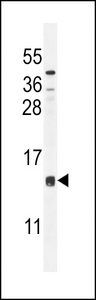 CCDC126 Antibody western blot of mouse liver tissue lysates (35 ug/lane). The CCDC126 antibody detected the CCDC126 protein (arrow).