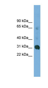 CCDC127 antibody LS-C116521 Western blot of COLO205 cell lysate.