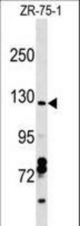 CCDC132 Antibody western blot of ZR-75-1 cell line lysates (35 ug/lane). The CCDC132 antibody detected the CCDC132 protein (arrow).