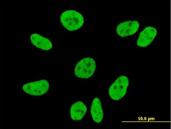 Immunofluorescence of monoclonal antibody to FLJ20097 on HeLa cell (antibody concentration 10 ug/ml).