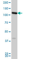 FLJ20097 monoclonal antibody (M01), clone 2D11 Western blot of FLJ20097 expression in HeLa.