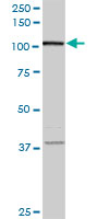 FLJ20097 monoclonal antibody (M01), clone 2D11. Western blot of FLJ20097 expression in human pancreas.