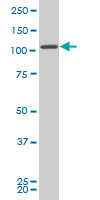FLJ20097 monoclonal antibody (M01), clone 2D11. Western blot of FLJ20097 expression in NIH/3T3.