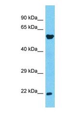 Western blot of CCDC134 Antibody with human Fetal Liver lysate.