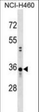 CCDC137 Antibody western blot of NCI-H460 cell line lysates (35 ug/lane). The CCDC137 antibody detected the CCDC137 protein (arrow).