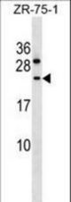 CCDC140 Antibody western blot of ZR-75-1 cell line lysates (35 ug/lane). The CCDC140 antibody detected the CCDC140 protein (arrow).