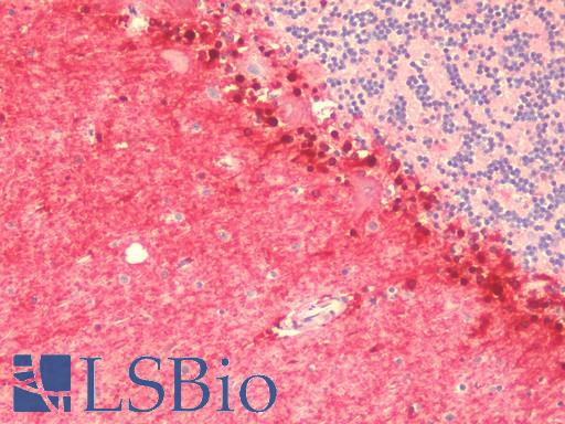 Anti-CCDC141 antibody IHC staining of human brain, cerebellum. Immunohistochemistry of formalin-fixed, paraffin-embedded tissue after heat-induced antigen retrieval. Antibody LS-B9522 concentration 5 ug/ml.