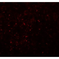 Immunofluorescence of CCDC141 in mouse brain tissue with CCDC141 antibody at 20 µg/mL.