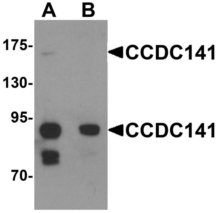 Western blot analysis of CCDC141 in SK-N-SH cell tissue lysate with CCDC141 antibody at 1 ug/ml in (A) the absence and (B) the presence of blocking peptide