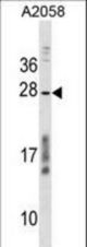 CCDC144NL Antibody western blot of A2058 cell line lysates (35 ug/lane). The CCDC144NL antibody detected the CCDC144NL protein (arrow).