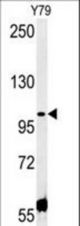 CCDC146 Antibody western blot of Y79 cell line lysates (35 ug/lane). The CCDC146 antibody detected the CCDC146 protein (arrow).