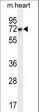 CCDC148 Antibody western blot of mouse heart tissue lysates (35 ug/lane). The CCDC148 antibody detected the CCDC148 protein (arrow).