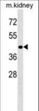 ACVR1B Antibody western blot of mouse kidney tissue lysates (35 ug/lane). The ACVR1B antibody detected the ACVR1B protein (arrow).