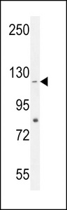 CCDC15 Antibody western blot of HepG2 cell line lysates (35 ug/lane). The CCDC15 antibody detected the CCDC15 protein (arrow).