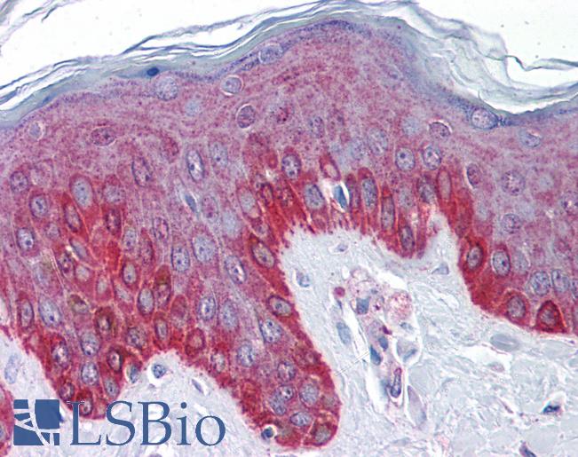 Anti-CCDC151 antibody IHC of human skin. Immunohistochemistry of formalin-fixed, paraffin-embedded tissue after heat-induced antigen retrieval. Antibody LS-B5834 concentration 5 ug/ml.