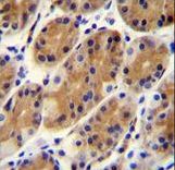 CCDC153 Antibody immunohistochemistry of formalin-fixed and paraffin-embedded human stomach tissue followed by peroxidase-conjugated secondary antibody and DAB staining.